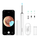 Bebird T15 Smart Visual Ear-Clean Rod