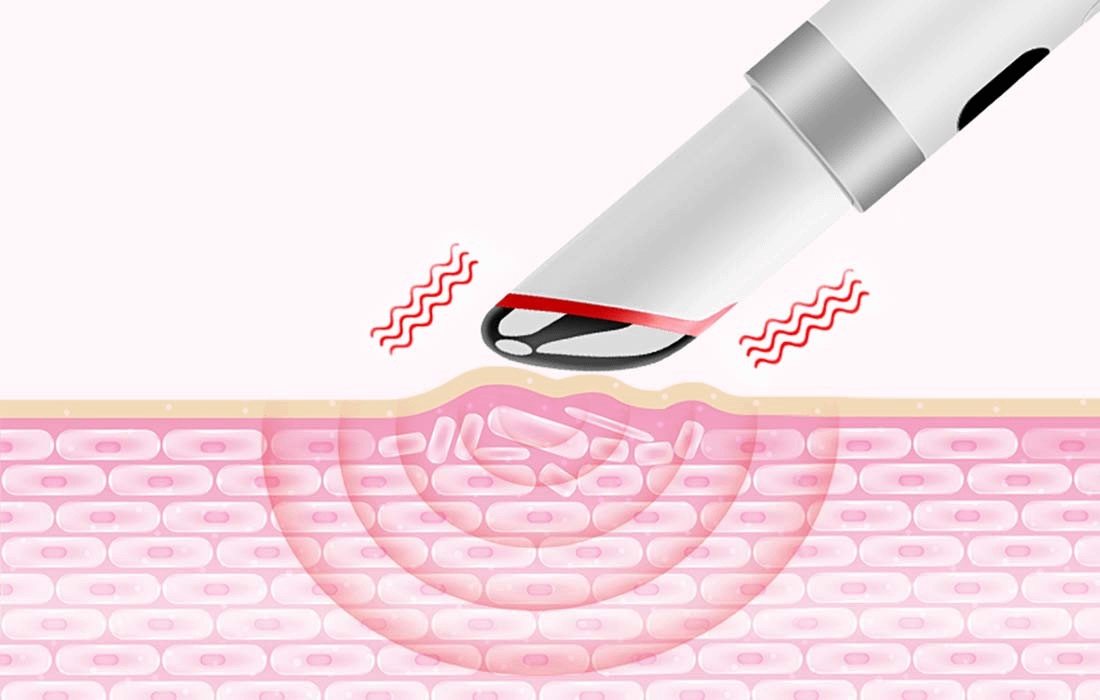 ANLAN ALMYY06-02 masažer za lice