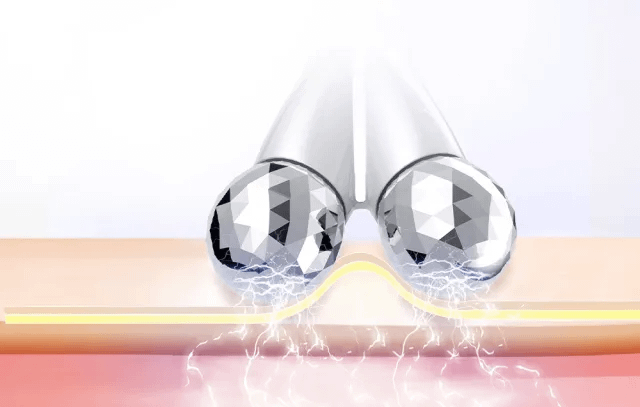 ANLAN 01-AAMY01-02A valjak