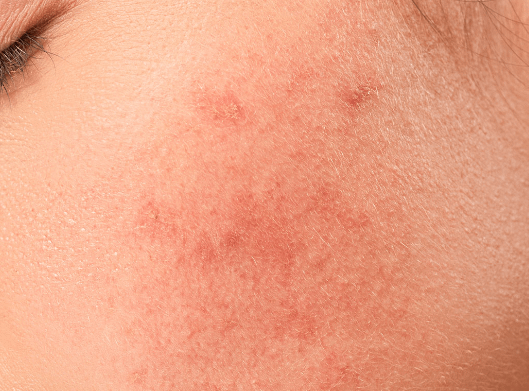 Voden Beauty Filter za umivanje