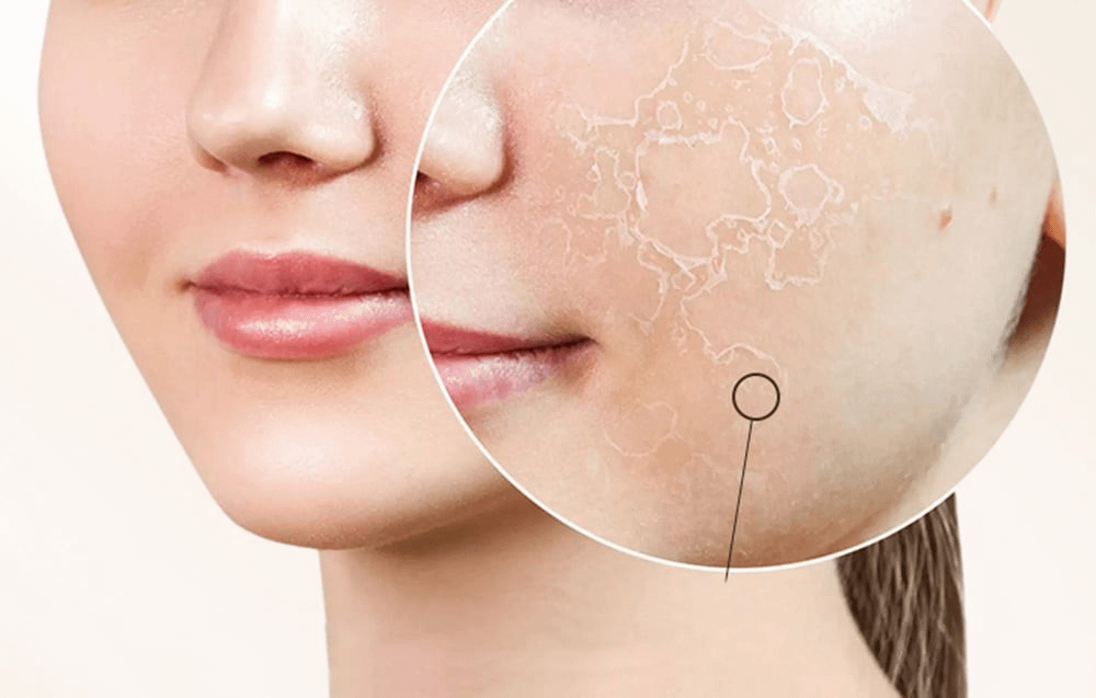 ANLAN 01-AVLY41-02A masažer za lice