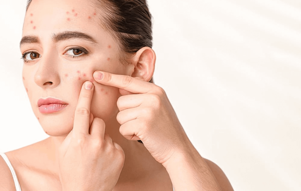 ANLAN 01-AVLY41-02A masažer za lice