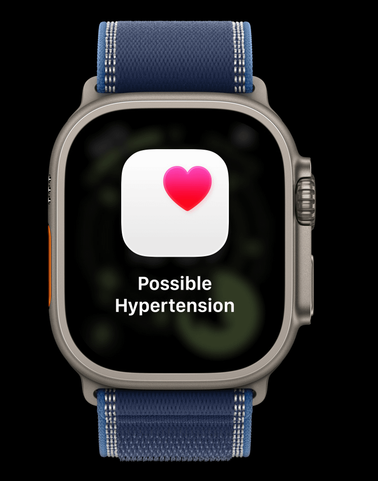 Apple Watch Ultra 3 Cellular 49mm Natural Titanium (Blue - Bright Blue Trail Loop) - M / L